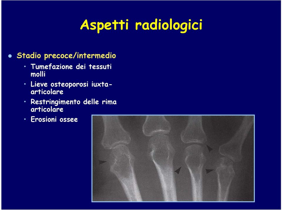 tessuti molli Lieve osteoporosi