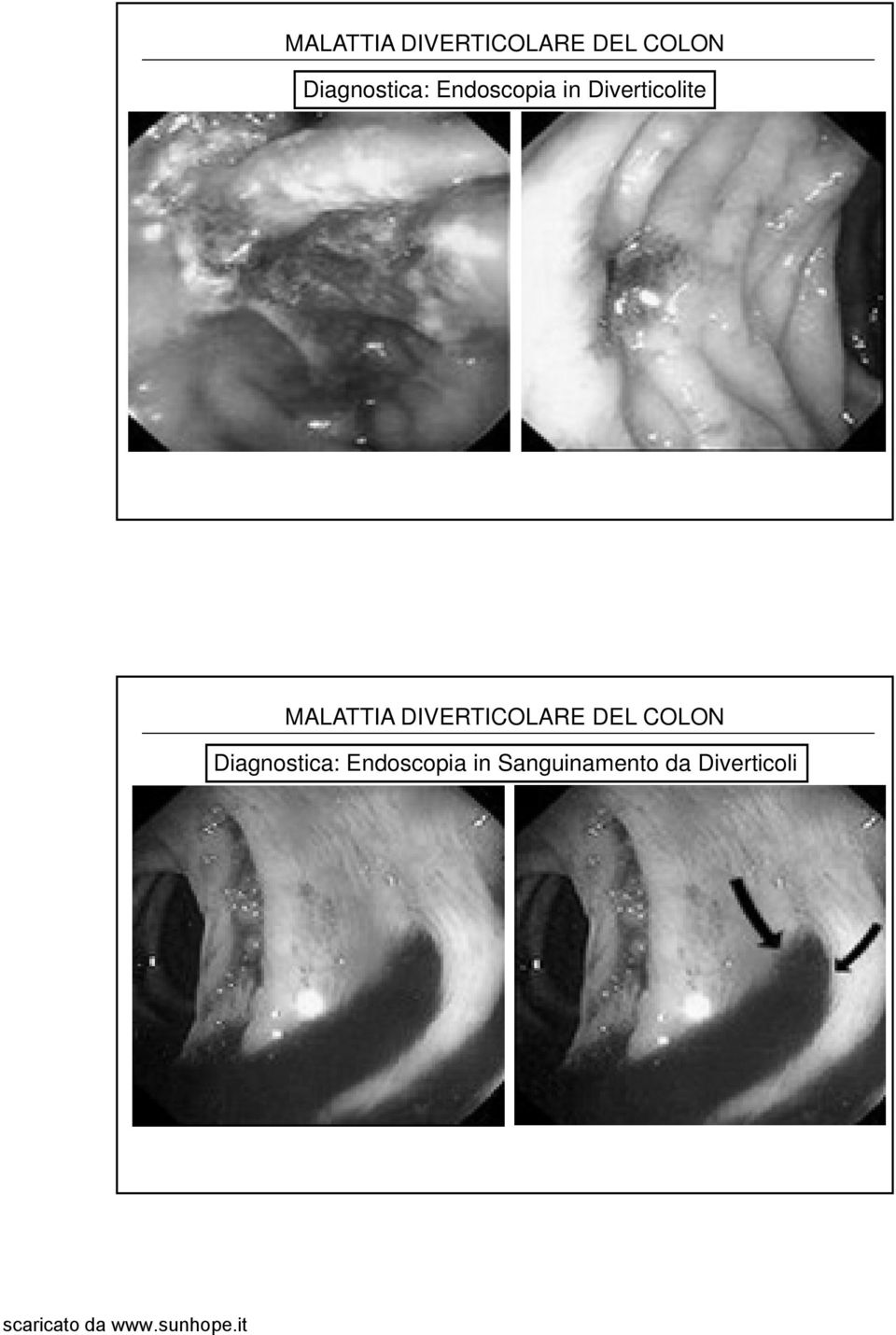 Diagnostica: Endoscopia in Sanguinamento