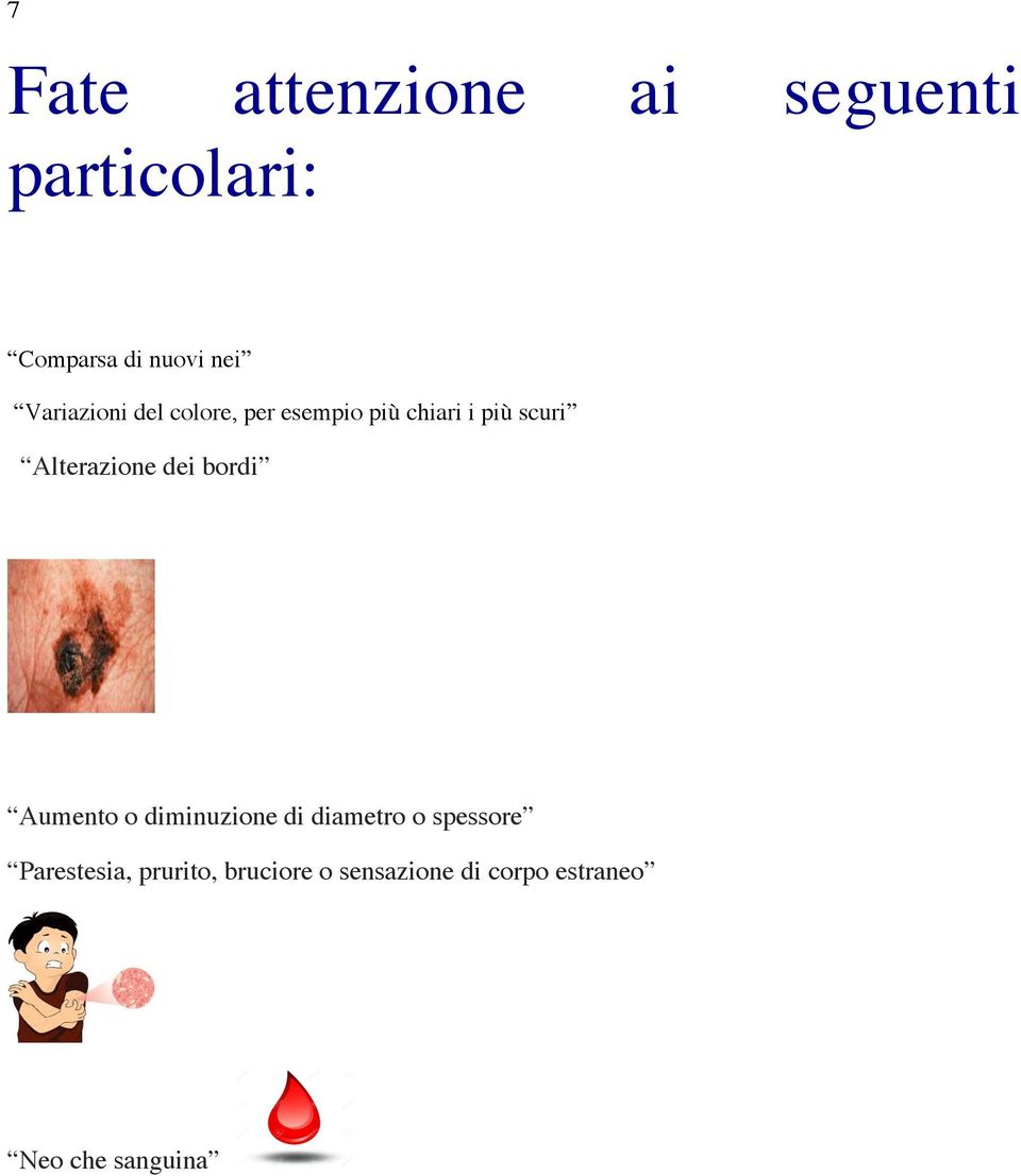 Alterazione dei bordi Aumento o diminuzione di diametro o spessore