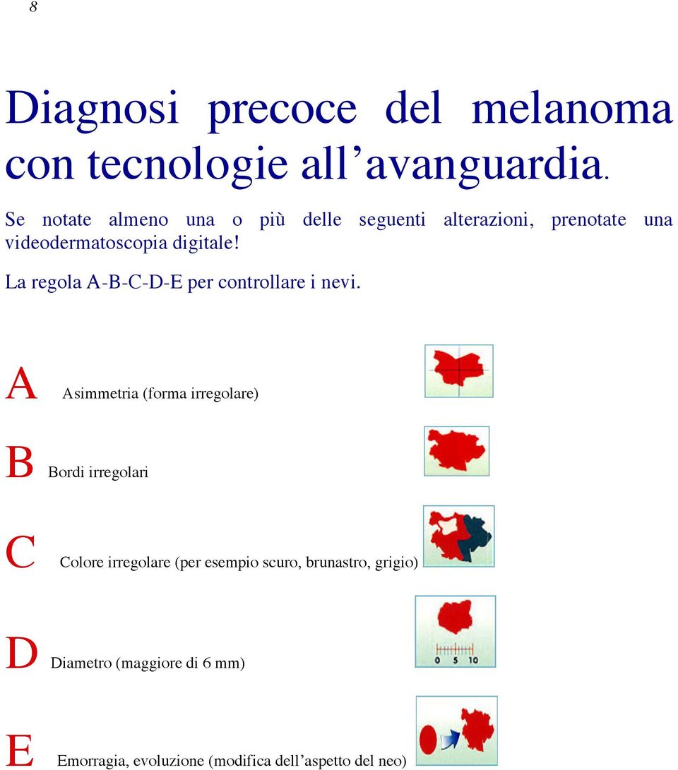 La regola A-B-C-D-E per controllare i nevi.