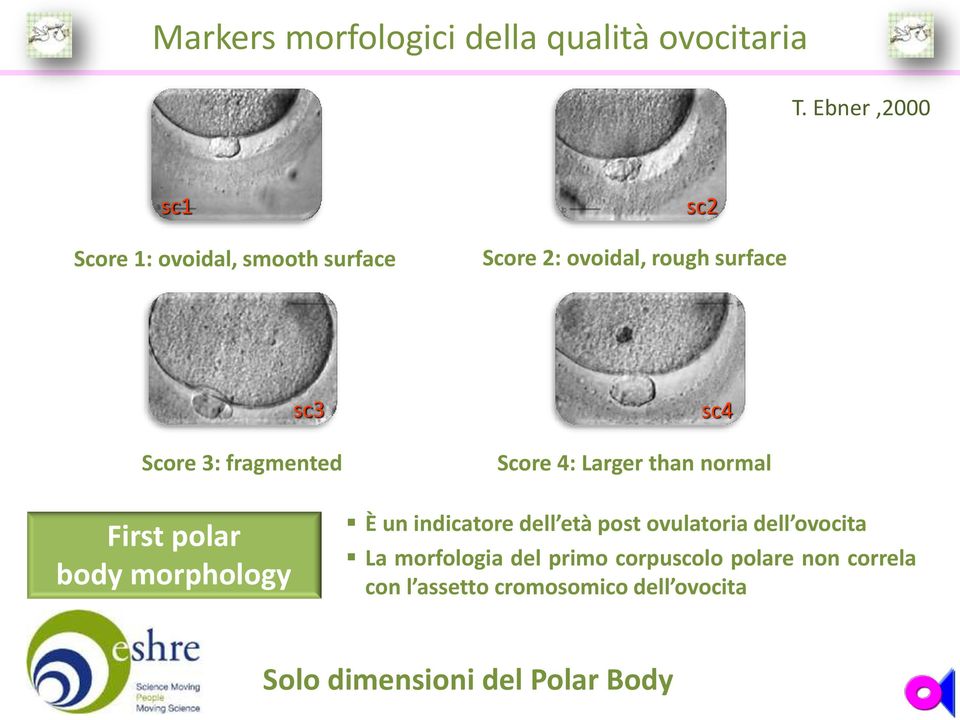 fragmented sc4 Score 4: Larger than normal First polar body morphology È un indicatore dell età