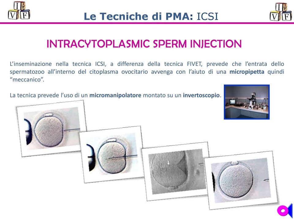 spermatozoo all interno del citoplasma ovocitario avvenga con l aiuto di una