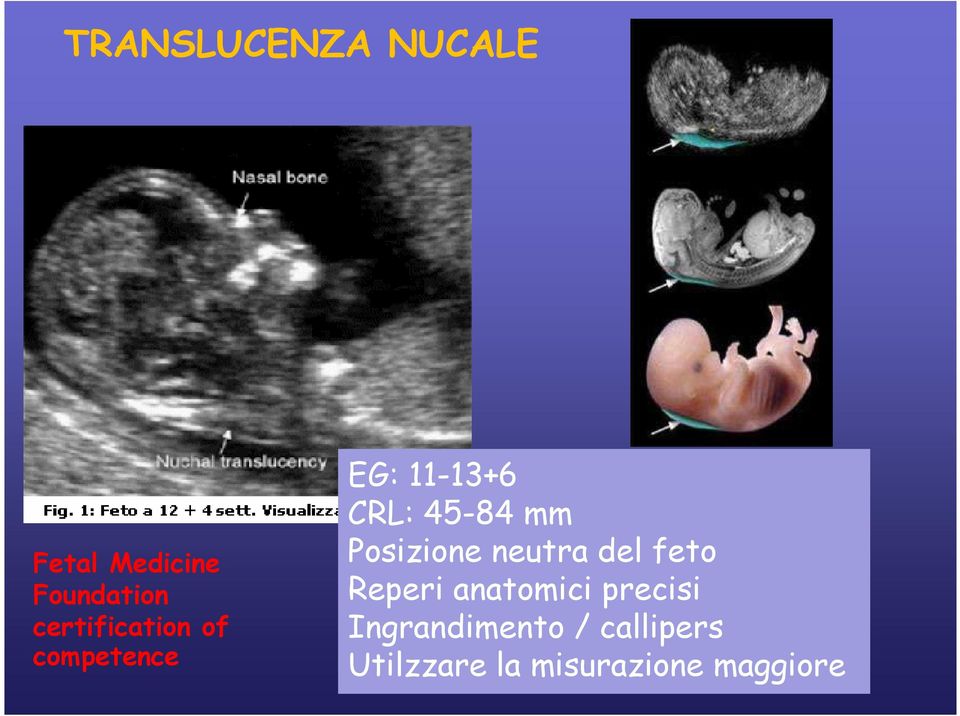 mm Posizione neutra del feto Reperi anatomici