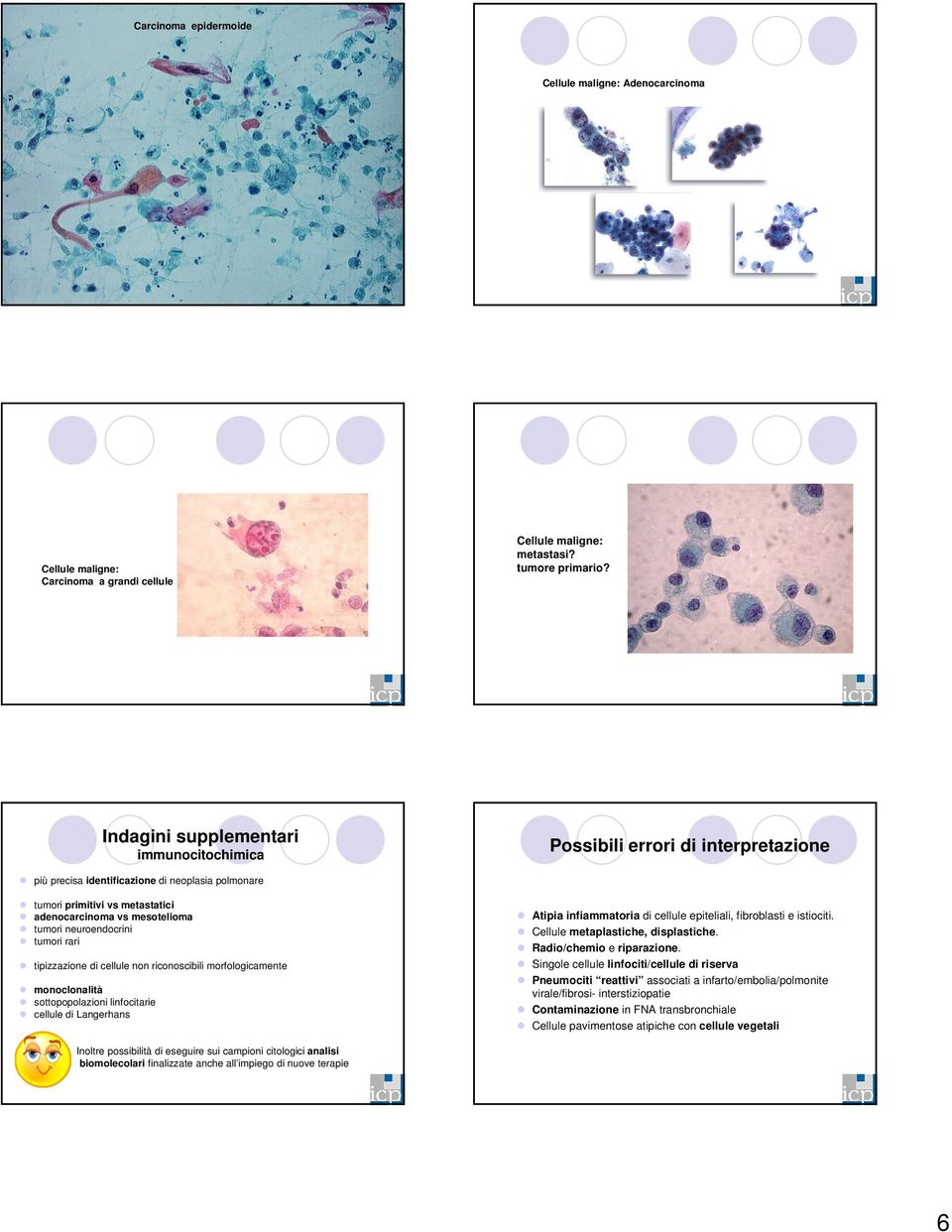 cellule non riconoscibili morfologicamente monoclonalità sottopopolazioni linfocitarie cellule di Langerhans Atipia infiammatoria di cellule epiteliali, fibroblasti e istiociti.