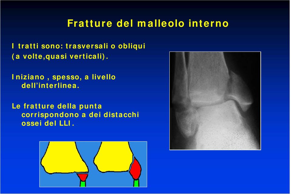 Iniziano, spesso, a livello dell interlinea.