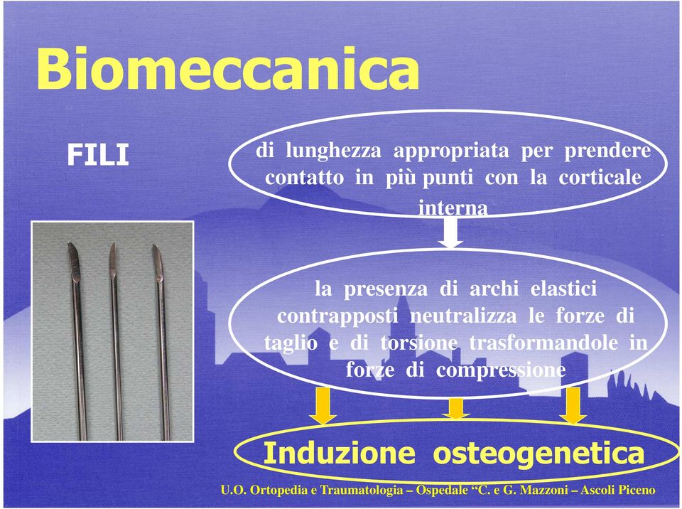 le forze di taglio e di torsione trasformandole in forze di compressione