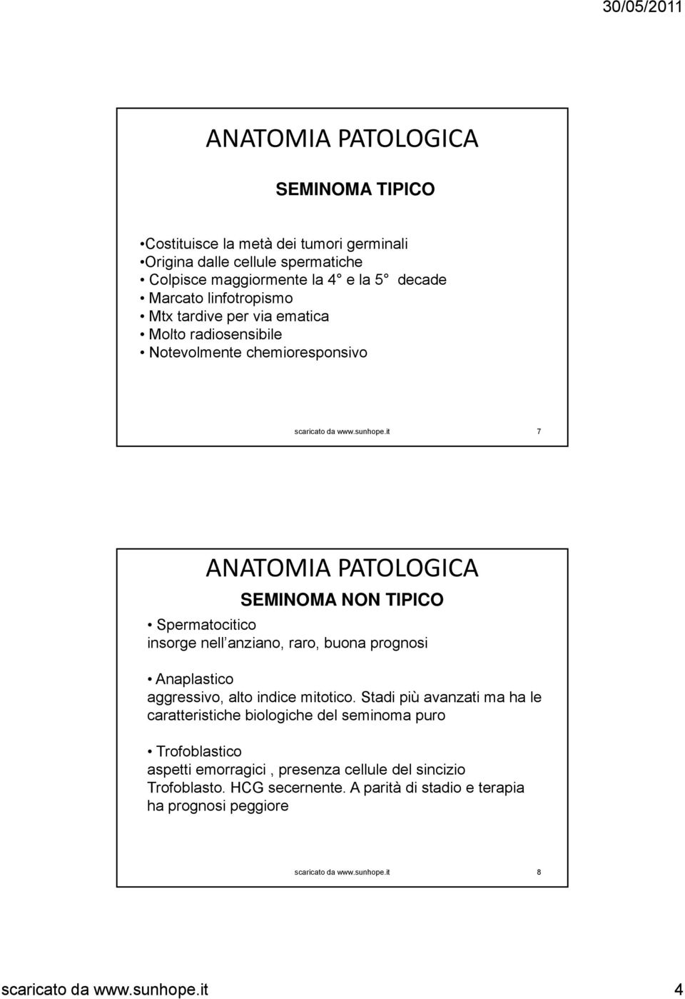 Spermatocitico insorge nell anziano, raro, buona prognosi Anaplastico aggressivo, alto indice mitotico.