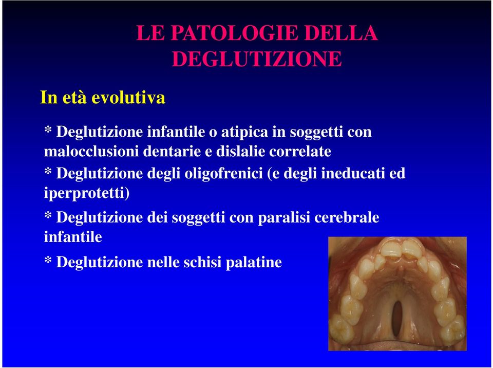 Deglutizione degli oligofrenici (e degli ineducati ed iperprotetti) *