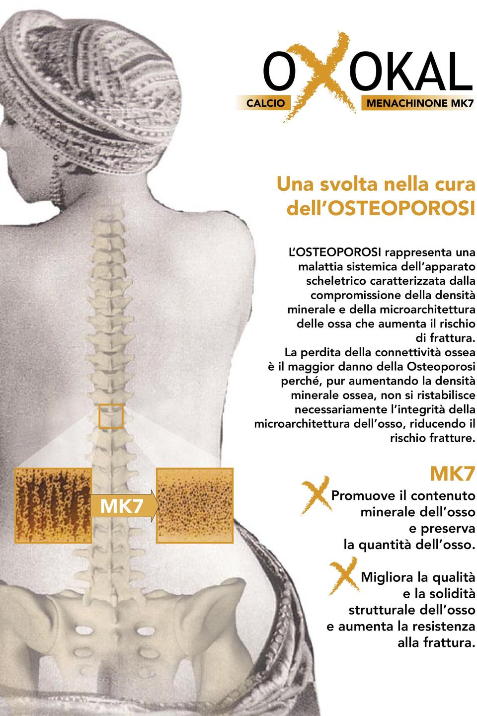 La perdita della connettività ossea è il maggior danno della Osteoporosi perché, pur aumentando la densità minerale ossea, non si ristabilisce necessariamente l