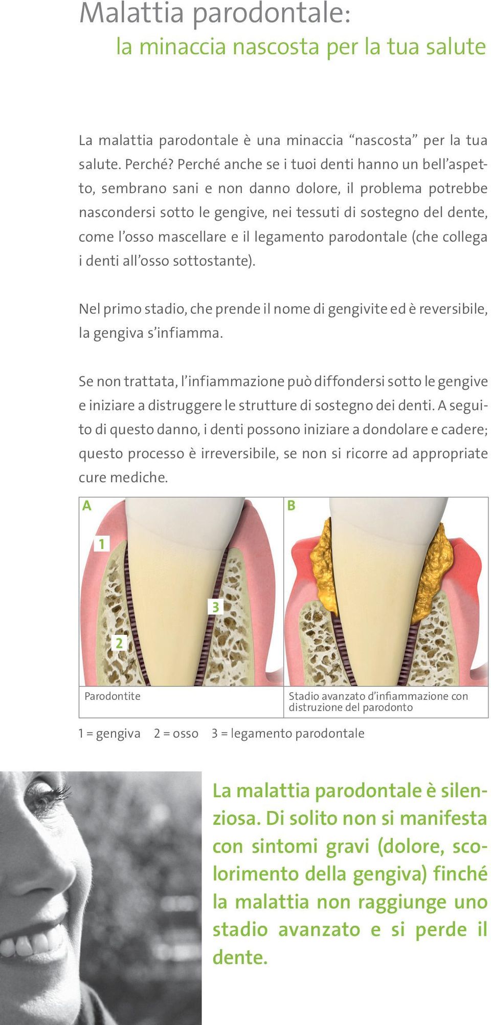 legamento parodontale (che collega i denti all osso sottostante). Nel primo stadio, che prende il nome di gengivite ed è reversibile, la gengiva s infiamma.