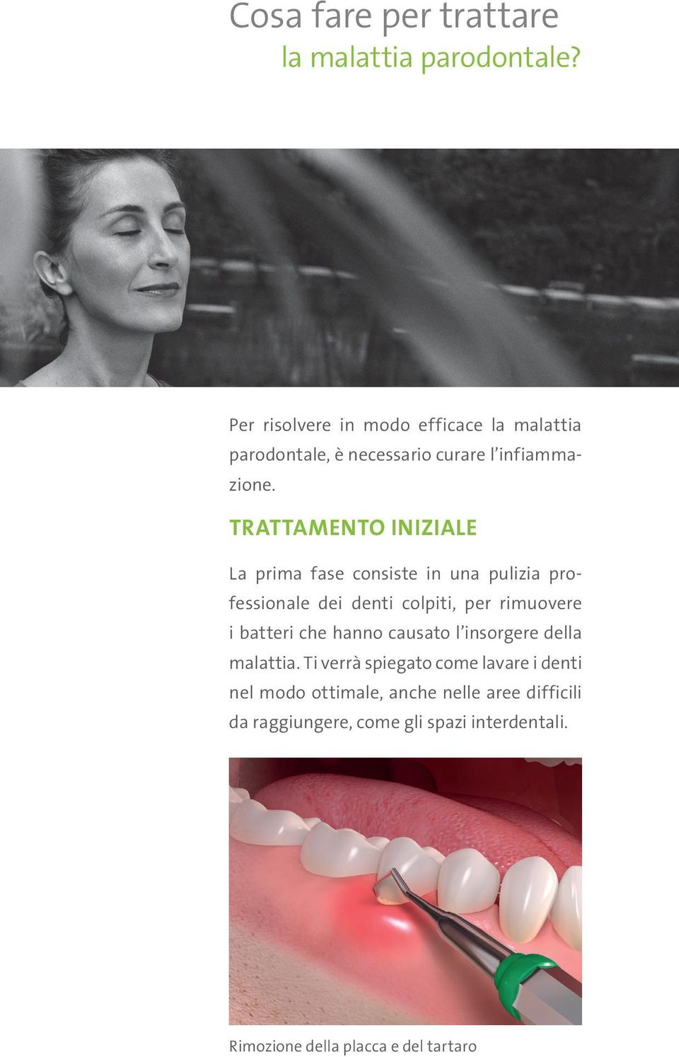 TRATTAMENTO INIZIALE La prima fase consiste in una pulizia professionale dei denti colpiti, per rimuovere i batteri