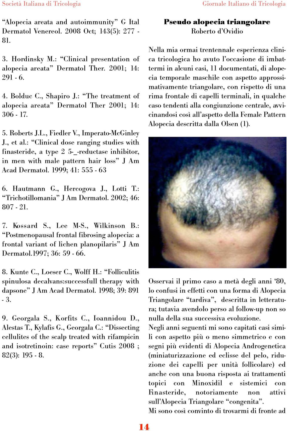 : Clinical dose ranging studies with finasteride, a type 2 5-_-reductase inhibitor, in men with male pattern hair loss J Am Acad Dermatol.