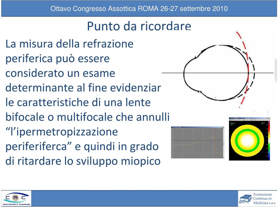 caratteristiche di una lente bifocale o multifocale che annulli l