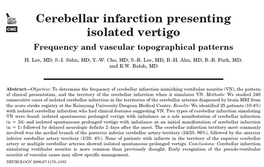 DIAGNOSI DIFFERENZIALE Patologie tronco-cerebellari: Vascolari PIC - AICA Demielinizzanti (SM) Neoplastiche BPPV canale laterale (nistagmo pseudo-spontaneo) Malattia di Meniere Neurinoma dell VIII n.