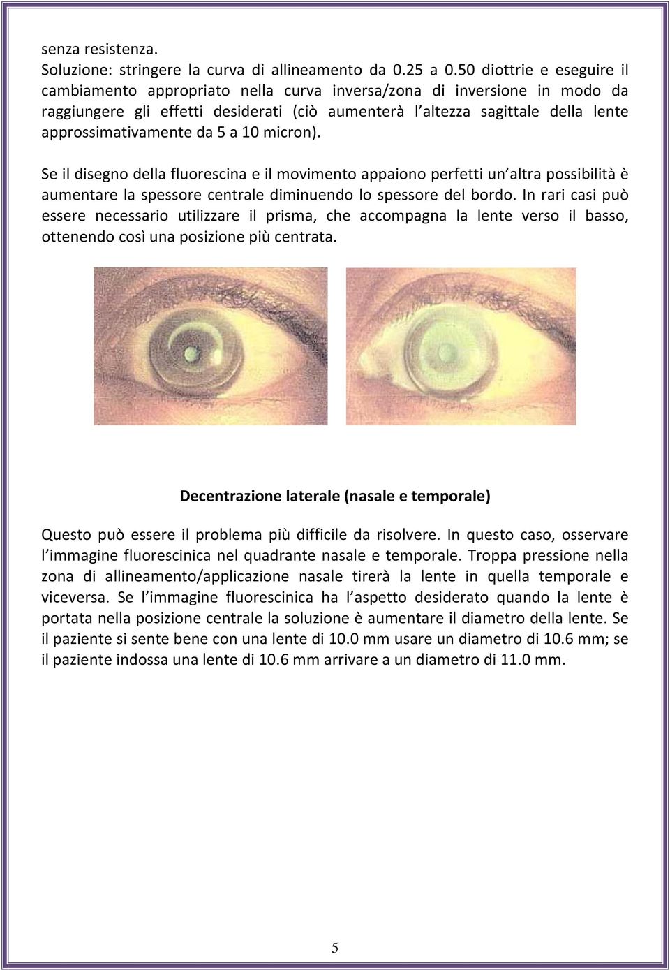 approssimativamente da 5 a 10 micron). Se il disegno della fluorescina e il movimento appaiono perfetti un altra possibilità è aumentare la spessore centrale diminuendo lo spessore del bordo.