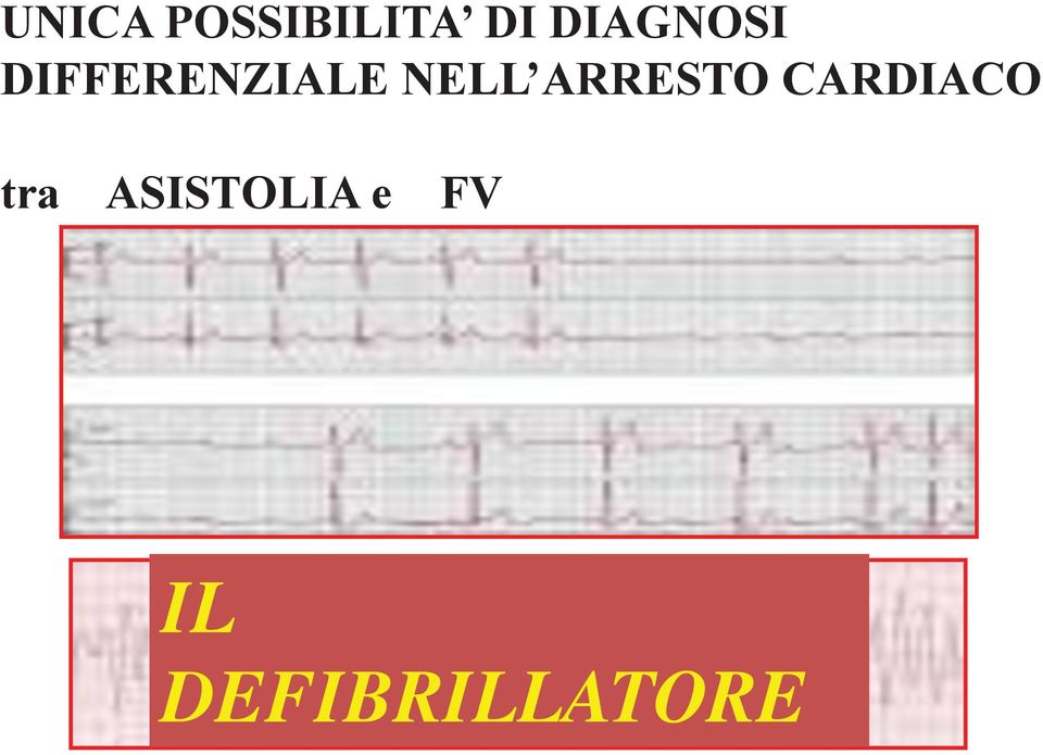 CARDIACO tra ASISTOLIA e FV