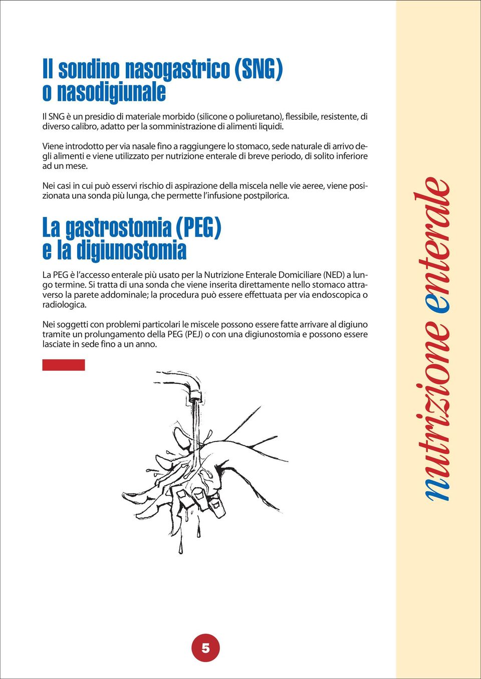 Nei casi in cui può esservi rischio di aspirazione della miscela nelle vie aeree, viene posizionata una sonda più lunga, che permette l infusione postpilorica.