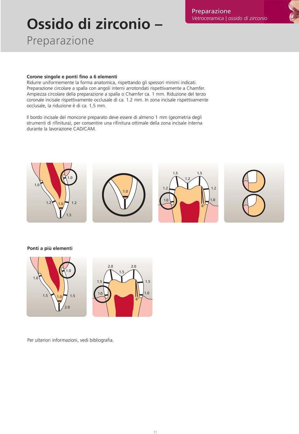 Riduzione del terzo coronale incisale rispettivamente occlusale di ca. 1.2 mm. In zona incisale rispettivamente occlusale, la riduzione è di ca. 1,5 mm.