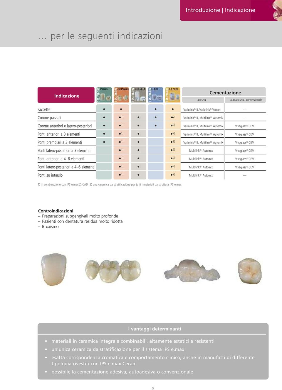 elementi 1) 2) Variolink II, Multilink Automix Vivaglass CEM Ponti latero-posteriori a 3 elementi 1) 2) Multilink Automix Vivaglass CEM Ponti anteriori a 4 6 elementi 1) 2) Multilink Automix