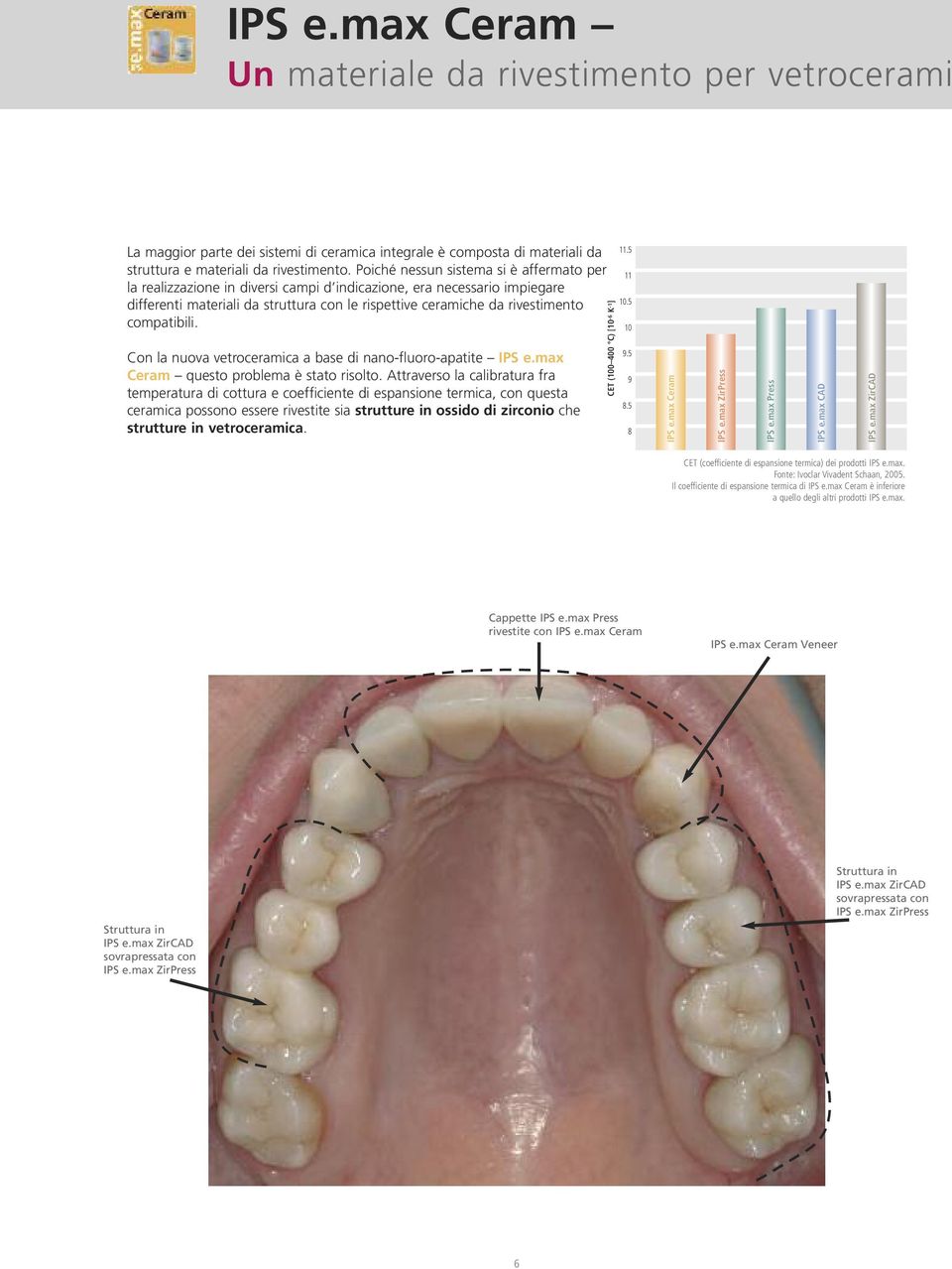 compatibili. Con la nuova vetroceramica a base di nano-fluoro-apatite IPS e.max Ceram questo problema è stato risolto.