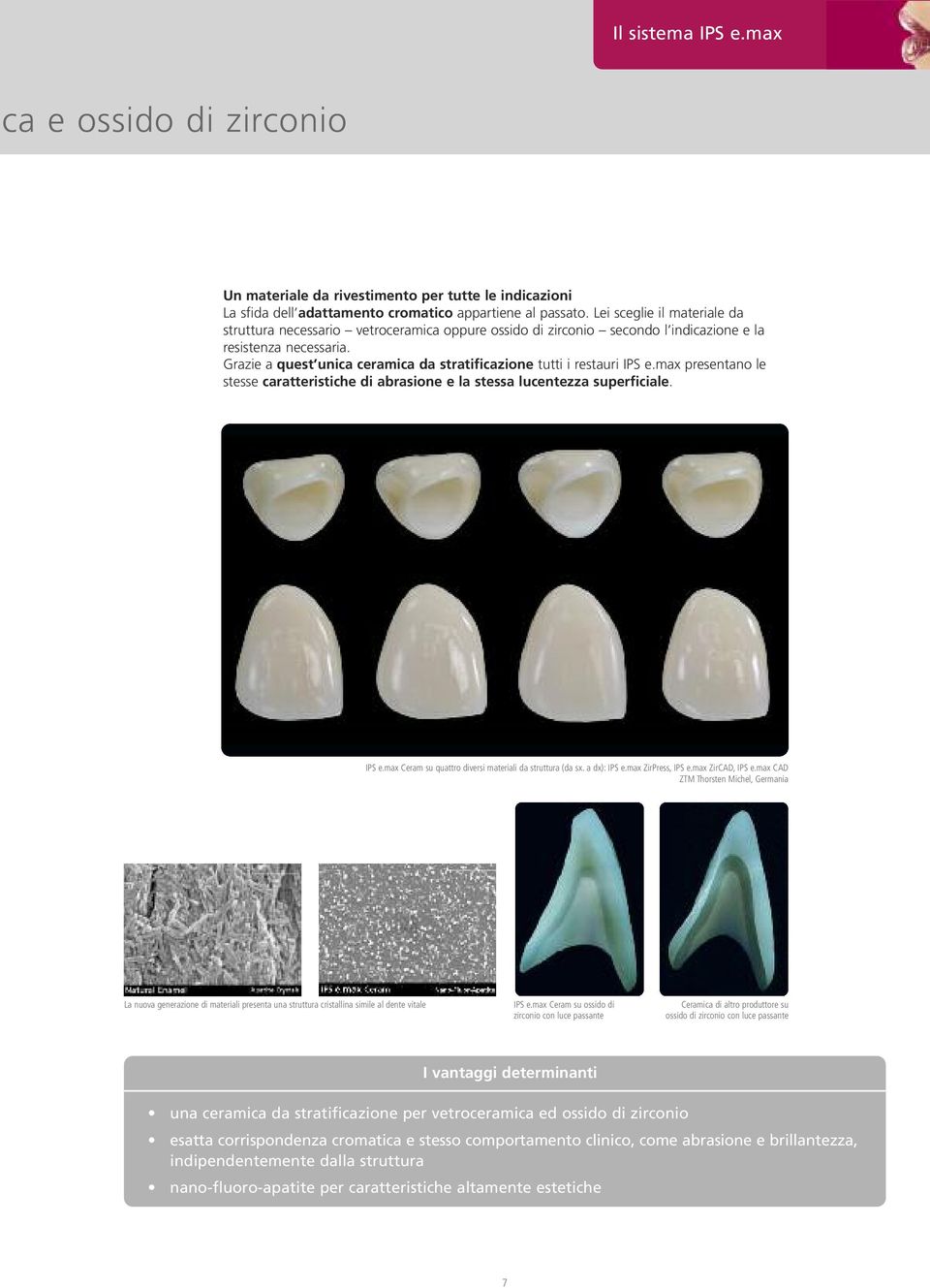 Grazie a quest unica ceramica da stratificazione tutti i restauri IPS e.max presentano le stesse caratteristiche di abrasione e la stessa lucentezza superficiale. IPS e.max Ceram su quattro diversi materiali da struttura (da sx.