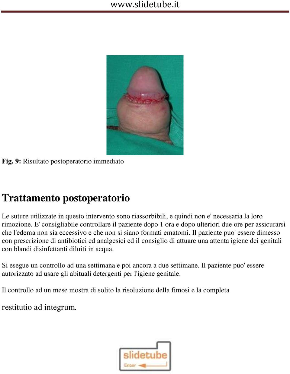 Il paziente puo' essere dimesso con prescrizione di antibiotici ed analgesici ed il consiglio di attuare una attenta igiene dei genitali con blandi disinfettanti diluiti in acqua.