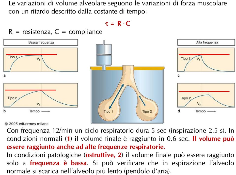 In condizioni normali (1) il volume finale è raggiunto in 0.6 sec. Il volume può essere raggiunto anche ad alte frequenze respiratorie.