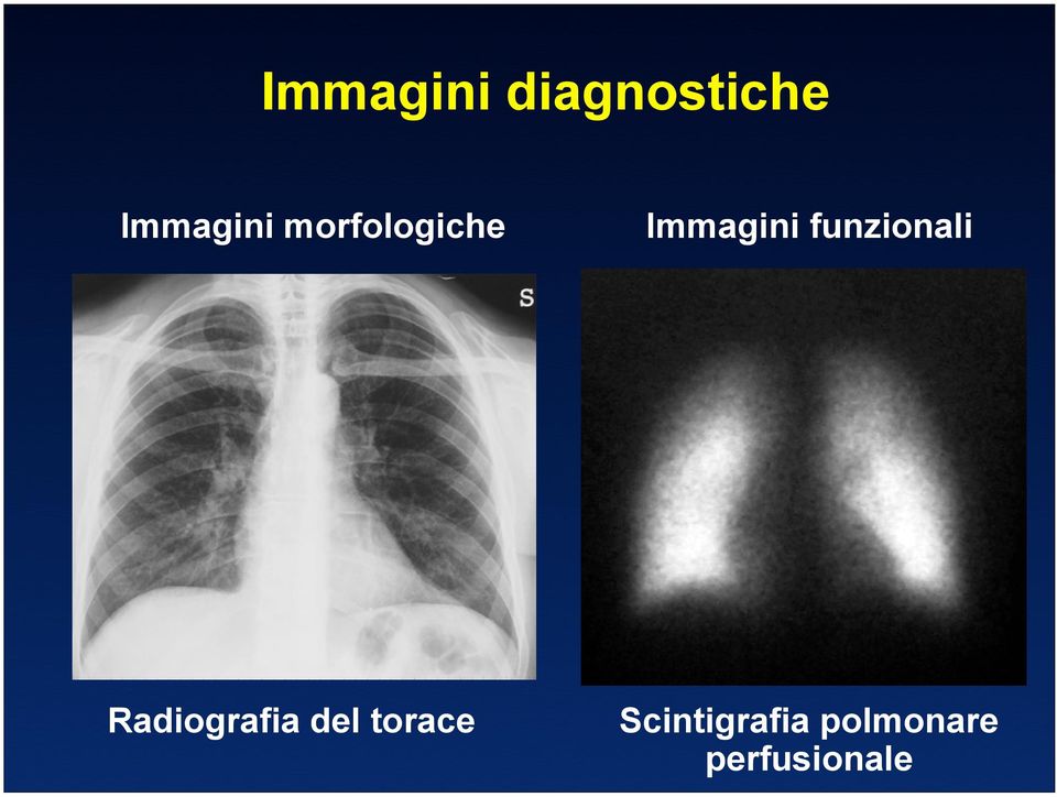 funzionali Radiografia del