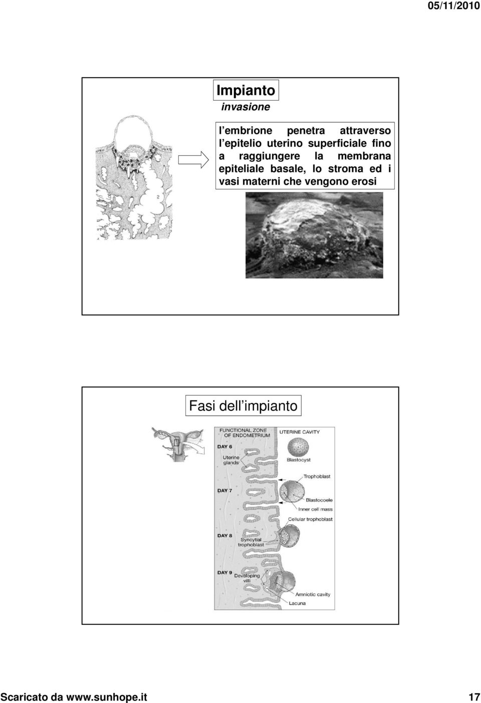 membrana epiteliale basale, lo stroma ed i vasi materni