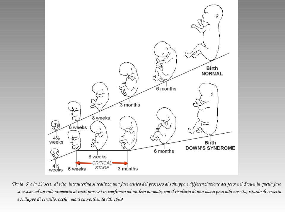 differenziazione del feto; nel Down in quella fase si assiste ad un rallentamento di