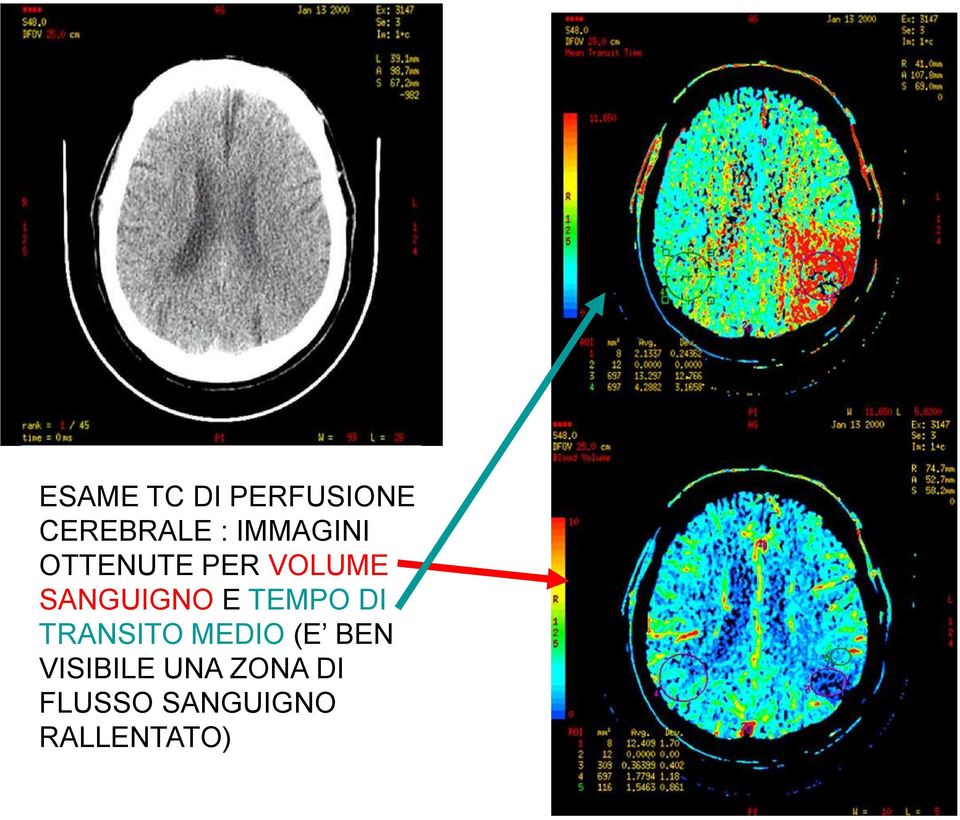 E TEMPO DI TRANSITO MEDIO (E BEN