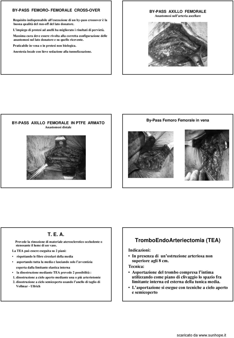 Praticabile in vena o in protesi non biologica. Anestesia locale con lieve sedazione alla tunnelizzazione.