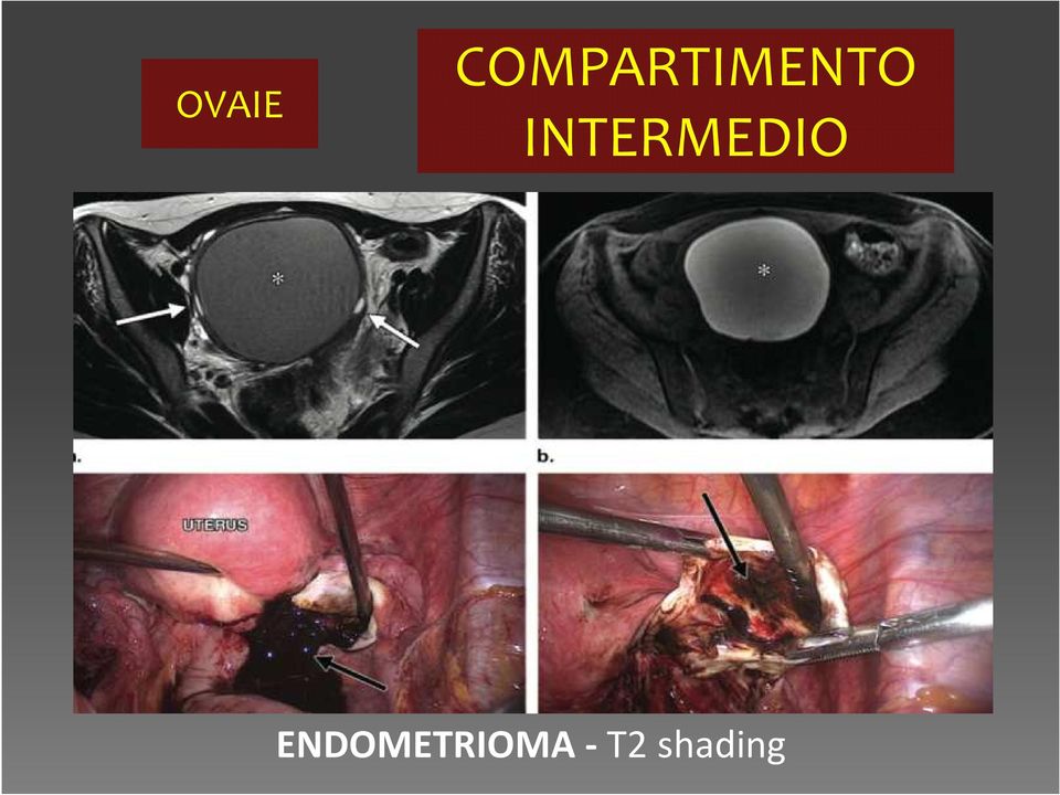 INTERMEDIO