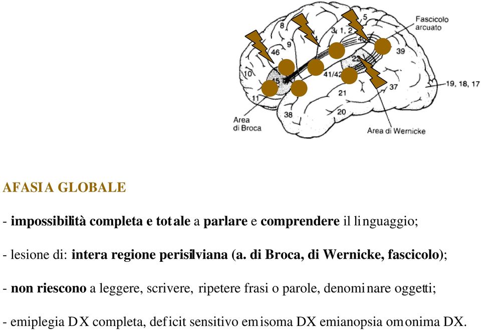 di Broca, di Wernicke, fascicolo); - non riescono a leggere, scrivere, ripetere