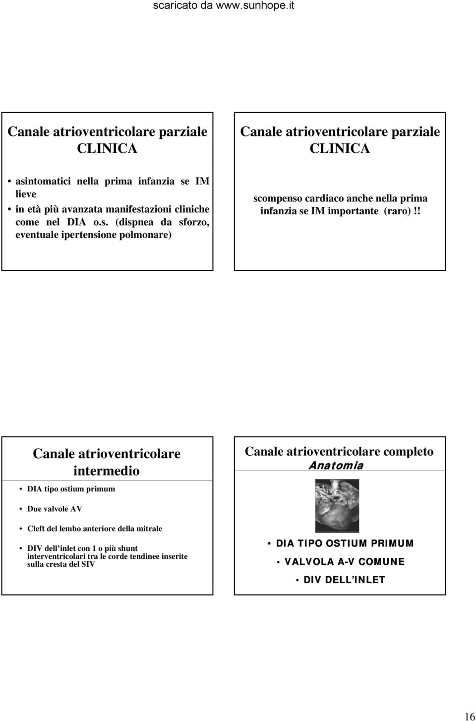 ! Canale atrioventricolare intermedio DIA tipo ostium primum Canale atrioventricolare completo Anatomia Due valvole AV Cleft del lembo anteriore della mitrale