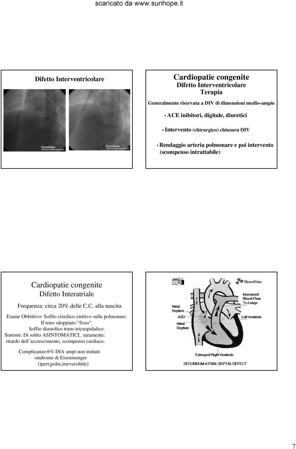 C. alla nascita Esame Obbittivo: Soffio sistolico eiettivo sulla polmonare. II tono sdoppiato fisso. Soffio diastolico trans-tricuspidalico.