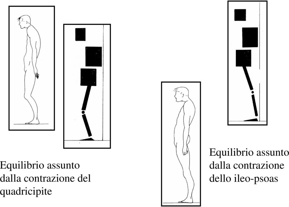 quadricipite  lo