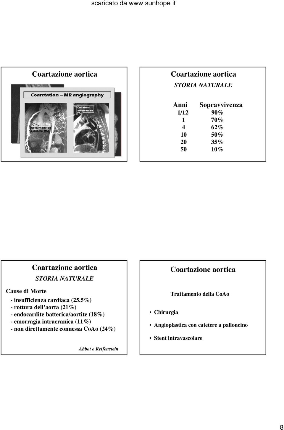5%) - rottura dell aorta (21%) - endocardite batterica/aortite (18%) - emorragia intracranica