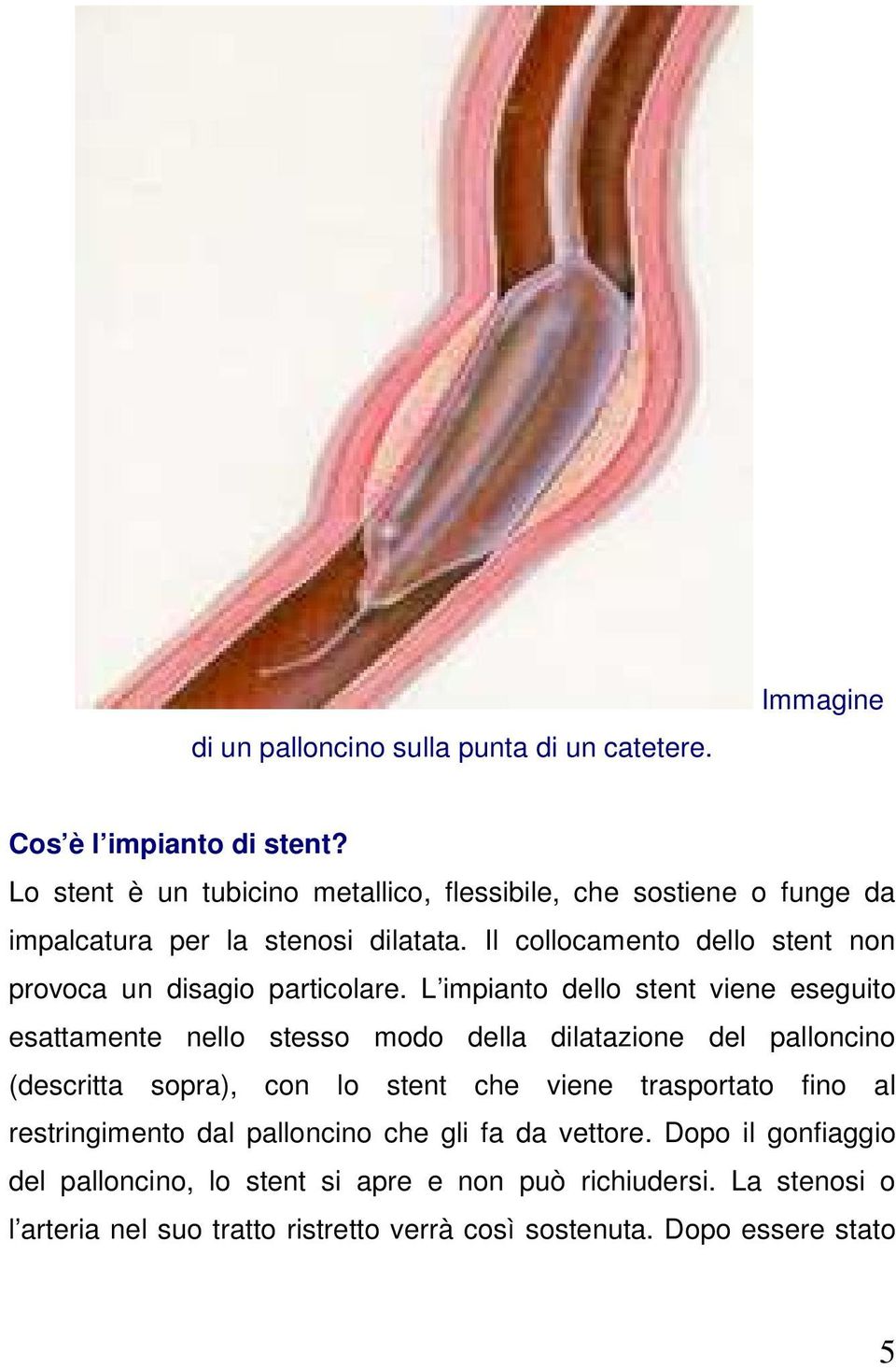 Il collocamento dello stent non provoca un disagio particolare.