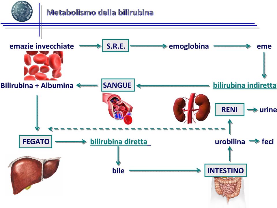 emoglobina eme Bilirubina + Albumina SANGUE
