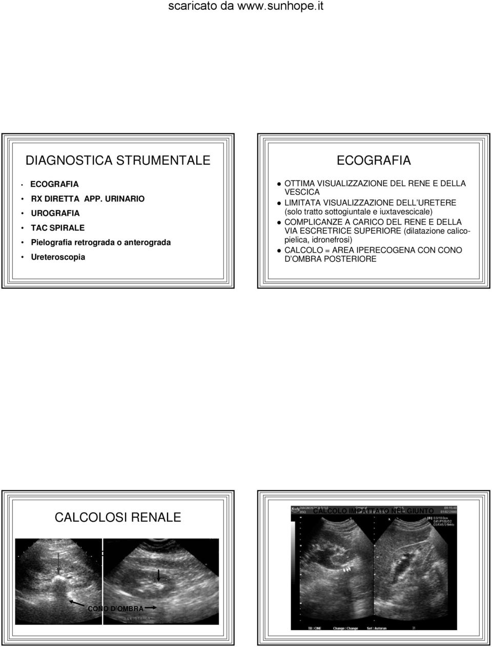 DELLA VESCICA LIMITATA VISUALIZZAZIONE DELL URETERE (solo tratto sottogiuntale e iuxtavescicale) COMPLICANZE A CARICO DEL RENE E