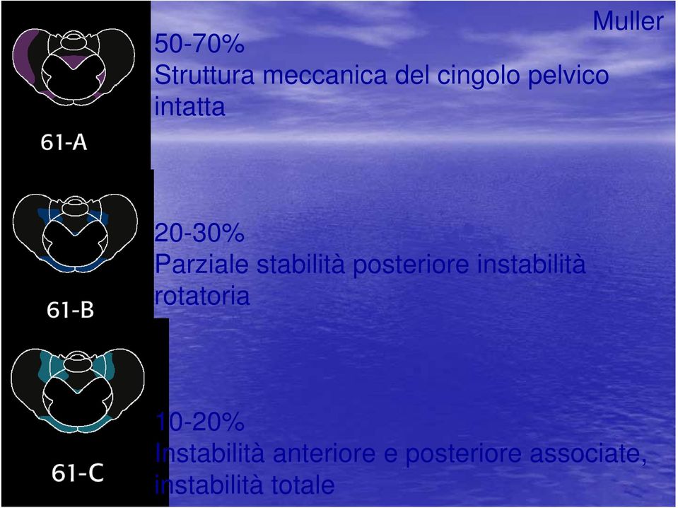 posteriore instabilità rotatoria 10-20%