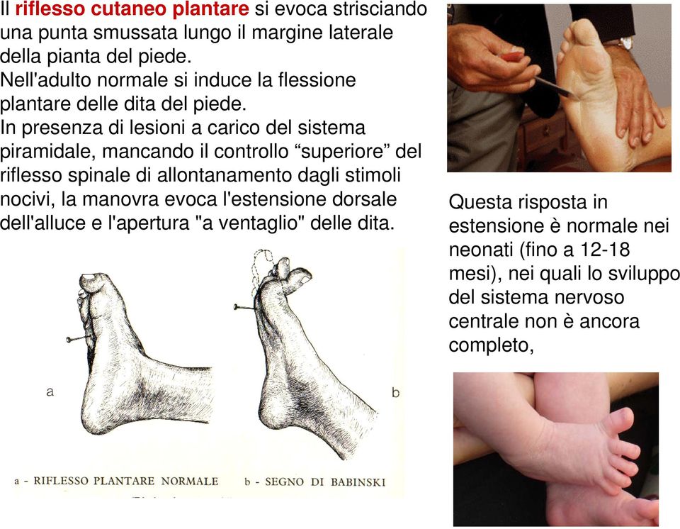 In presenza di lesioni a carico del sistema piramidale, mancando il controllo superiore del riflesso spinale di allontanamento dagli stimoli