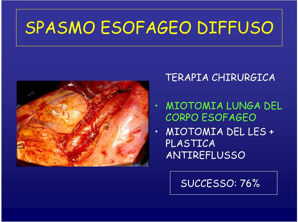 CORPO ESOFAGEO MIOTOMIA DEL LES