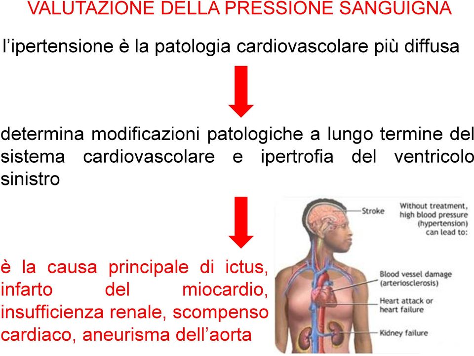 del sistema cardiovascolare e ipertrofia del ventricolo sinistro è la causa