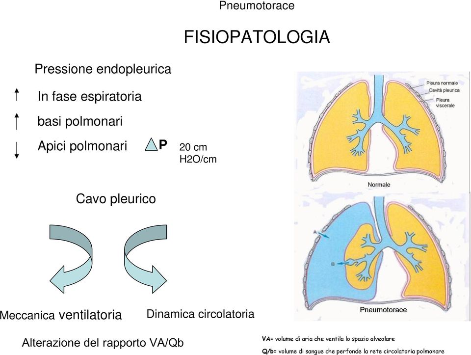 circolatoria Alterazione del rapporto VA/Qb VA= volume di aria che ventila lo