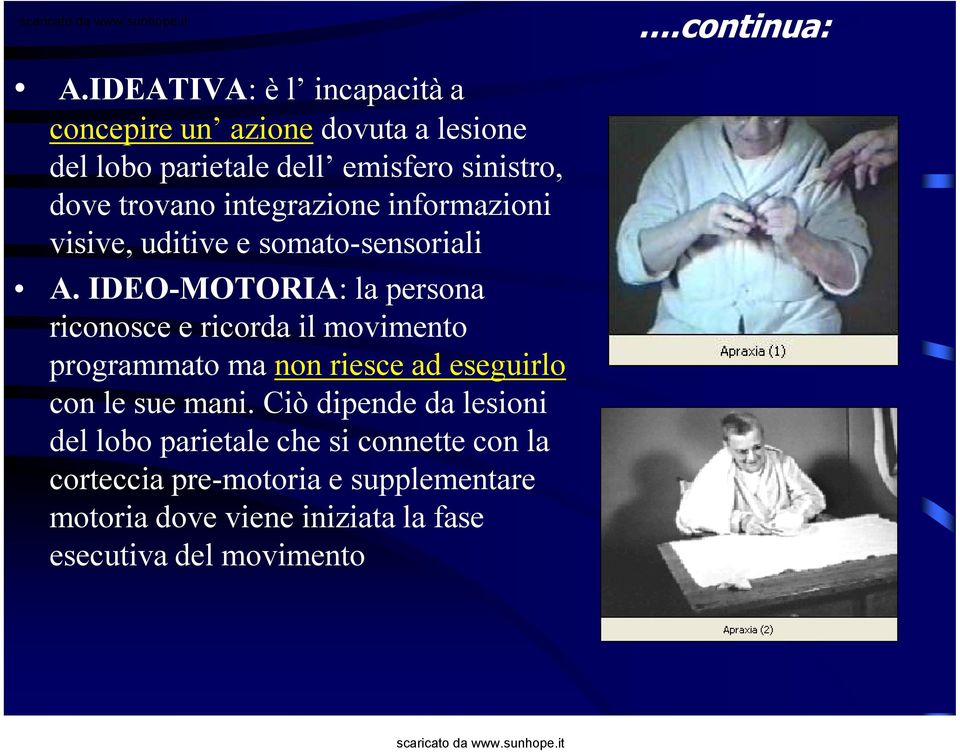 trovano integrazione informazioni visive, uditive e somato-sensoriali A.