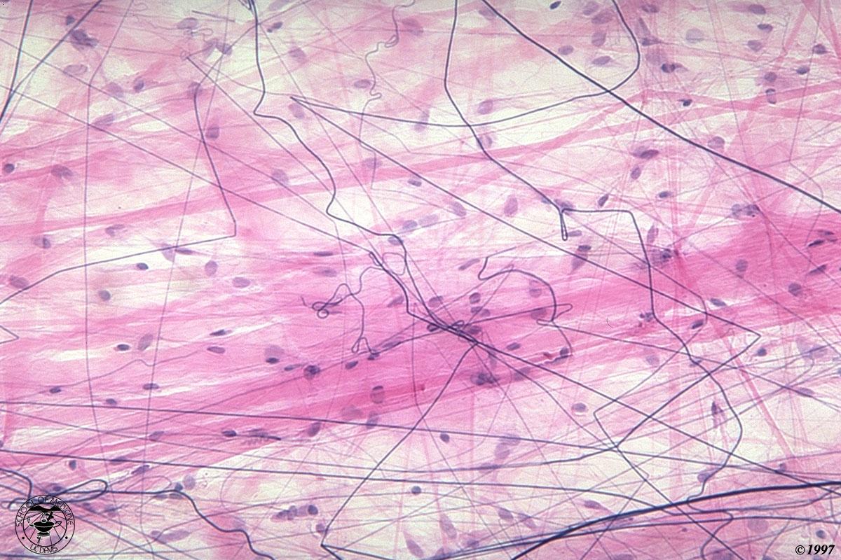 tessuto connettivo lasso in rosa: fasci di fibre collagene di diverso spessore in nero: