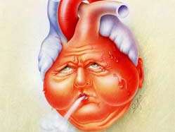 Terapia dell insufficienza cardiaca acuta in Cure Intense Dr. med.