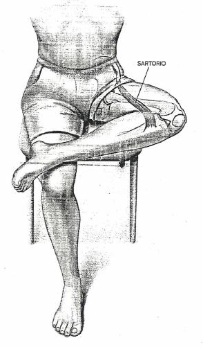 Anteriori della coscia: sartorio Il sartorio è il muscolo più lungo del corpo: dalla spina iliaca anteriore superiore (SIAS) del bacino si inserisce sul condilo mediale della tibia attraversando